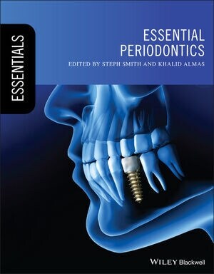 Essential Periodontics (Paperback)