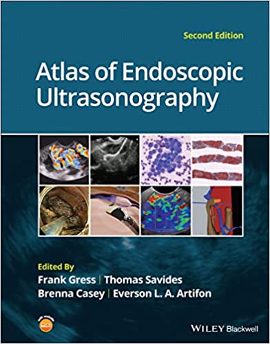 Atlas of Endoscopic Ultrasonography (Hardcover, 2)