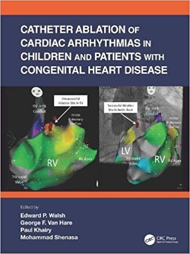 Catheter Ablation of Cardiac Arrhythmias in Children and Patients with Congenital Heart Disease (Paperback, 1)