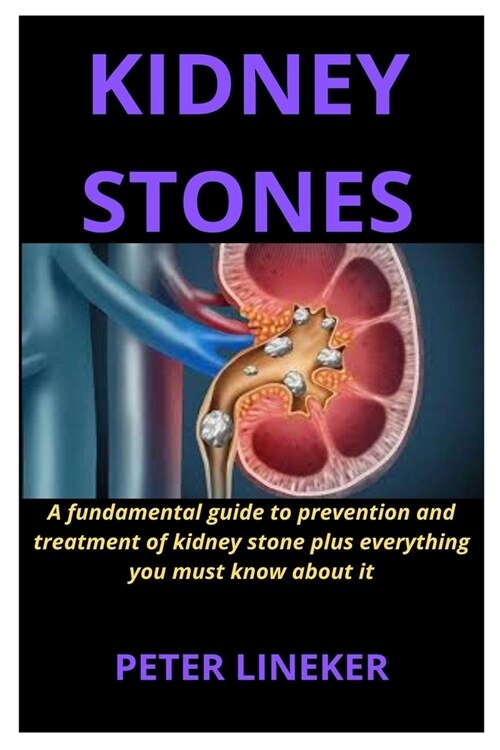 Kidney Stones: A fundamental guide to prevention and treatment of kidney stone plus everything you must know about it (Paperback)