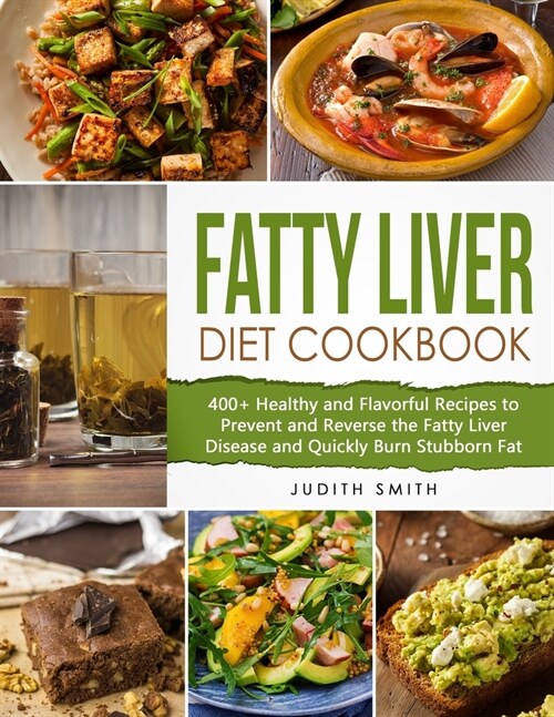 Fatty Liver Diet Cookbook: 400+ Healthy and Flavorful Recipes to Prevent and Reverse the Fatty Liver Disease and Quickly Burn Stubborn Fat (Paperback)