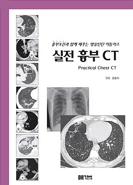 실전 흉부 CT