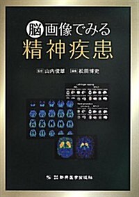 腦畵像でみる精神疾患 (單行本)