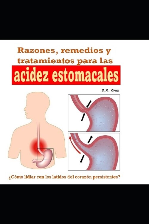 Razones, remedios y tratamientos para las acidez estomacales: 풠?o lidiar con los latidos del coraz? persistentes? (Paperback)