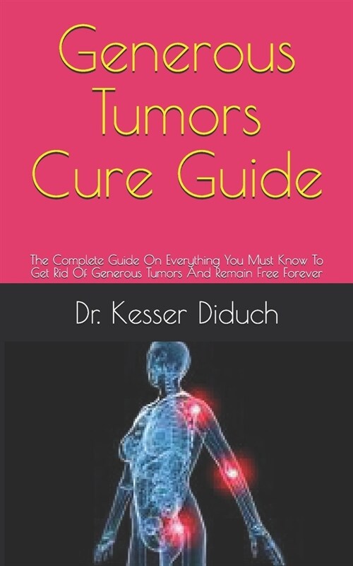 Generous Tumors Cure Guide: The Complete Guide On Everything You Must Know To Get Rid Of Generous Tumors And Remain Free Forever (Paperback)