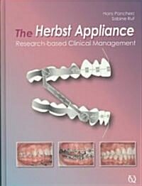 The Herbst Appliance: Research-Based Clinical Management (Hardcover)