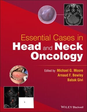 Essential Cases in Head and Neck Oncology (Paperback)