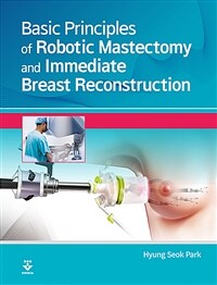 Basic principles of robotic mastectomy and immediate breast reconstruction