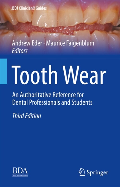 Tooth Wear: An Authoritative Reference for Dental Professionals and Students (Hardcover, 3, 2022)