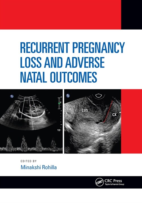 Recurrent Pregnancy Loss and Adverse Natal Outcomes (Paperback, 1)