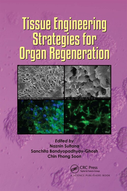 Tissue Engineering Strategies for Organ Regeneration (Paperback, 1)