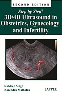 Step by Step: 3D/4D Ultrasound in Obstetrics, Gynecology and Infertility (Paperback, 2)