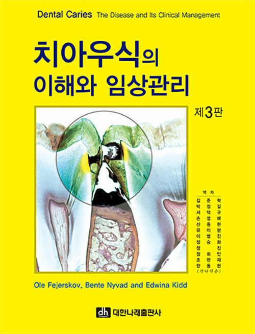 치아우식의 이해와 임상관리