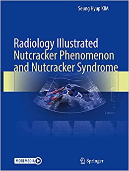 Radiology Illustrated: Nutcracker Phenomenon and Nutcracker Syndrome (Hardcover)