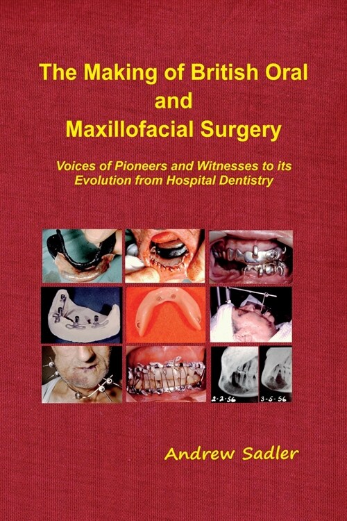 The The Making of British Oral and Maxillofacial Surgery : Voices of Pioneers and Witnesses to its Evolution from Hospital Dentistry (Paperback)