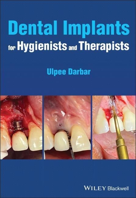 Dental Implants for Hygienists and Therapists (Paperback)