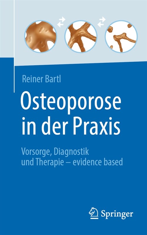 Osteoporose in Der Praxis: Vorsorge, Diagnostik Und Therapie - Evidence Based (Paperback, 1. Aufl. 2022)