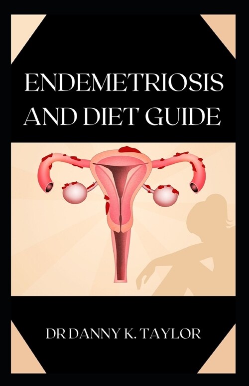 Endemetriosis and Diet Guide: The Definitive Guide on Endemetriosis and its Diet Plan (Paperback)