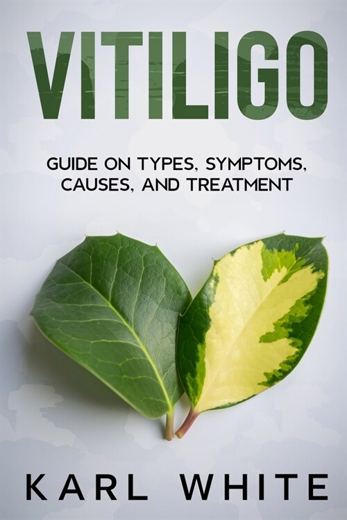 Vitiligo: Guide on Types, Symptoms, Causes, and Treatment (Paperback)