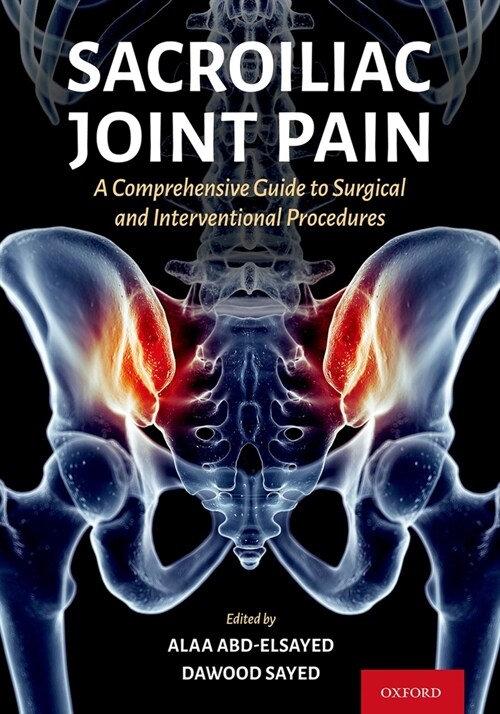 Sacroiliac Joint Pain: A Comprehensive Guide to Interventional and Surgical Procedures (Paperback)