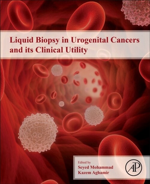 Liquid Biopsy in Urogenital Cancers and its Clinical Utility (Paperback)