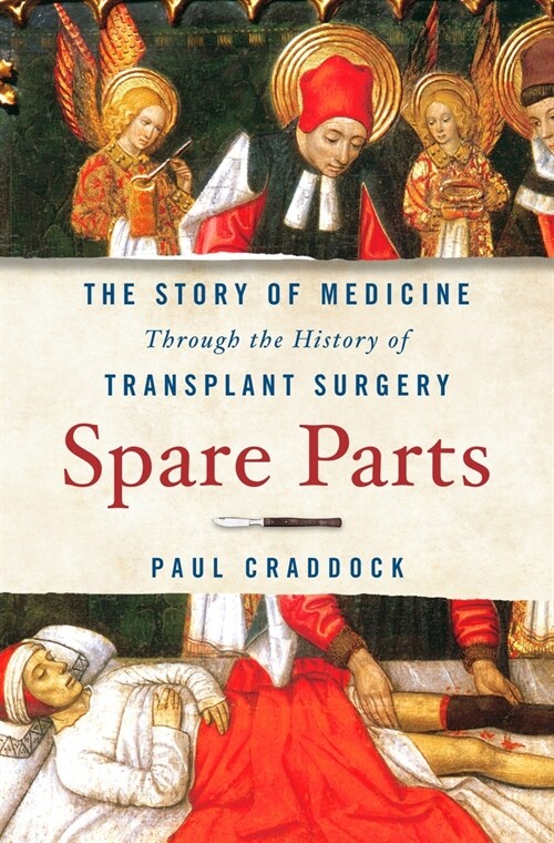 Spare Parts: The Story of Medicine Through the History of Transplant Surgery (Hardcover)