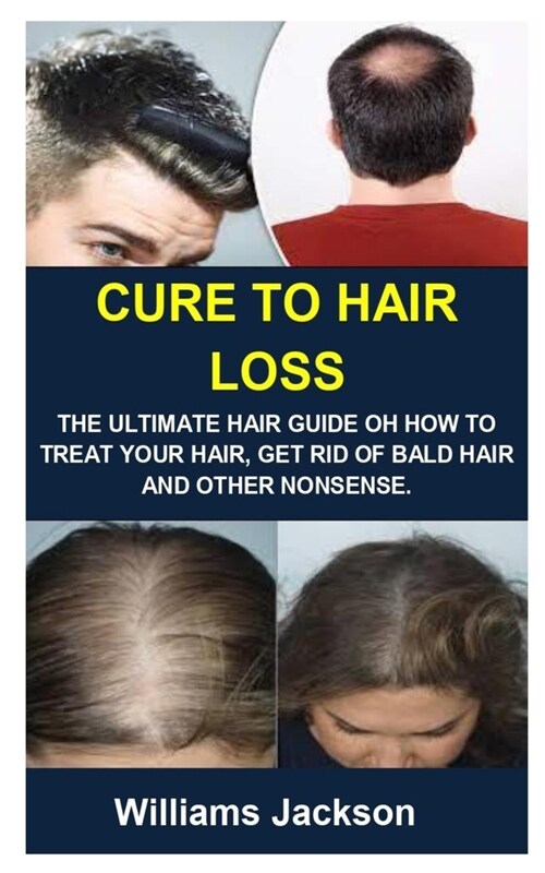 Cure to Hair Loss: Cure to Hair Loss: The Ultimate Hair Guide Oh How to Treat Your Hair, Get Rid of Bald Hair and Other Nonsense. (Paperback)