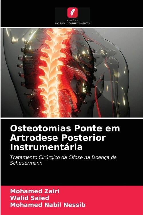 Osteotomias Ponte em Artrodese Posterior Instrument?ia (Paperback)