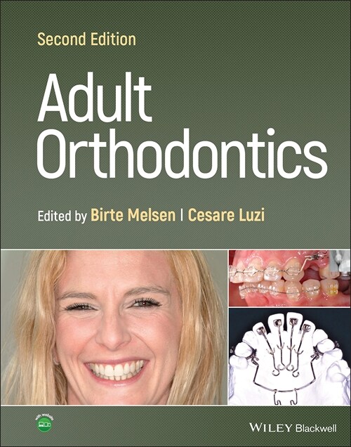 Adult Orthodontics (Hardcover, 2)