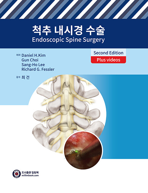 척추 내시경 수술