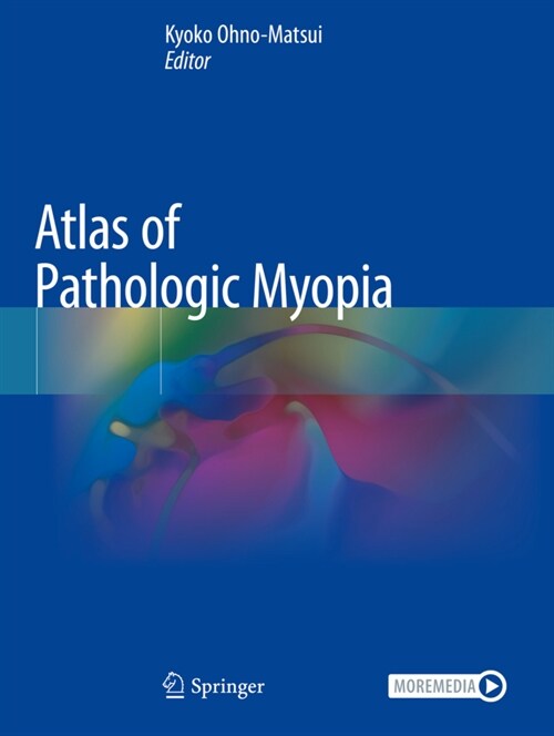 Atlas of Pathologic Myopia (Paperback)