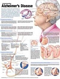 Understanding Alzheimers Disease Anatomical Chart (Other, 2)