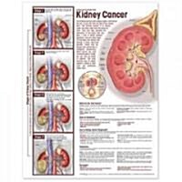 Understanding Kidney Cancer Anatomical Chart (Paperback, 1st, LAM, Wall)