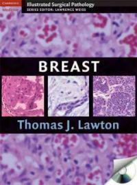 Breast