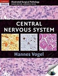 Nervous System (Hardcover)