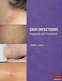 Skin Infections : Diagnosis and Treatment (Hardcover)