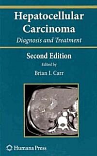 Hepatocellular Carcinoma: Diagnosis and Treatment (Hardcover, 2)