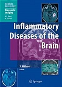 Inflammatory Diseases of the Brain (Hardcover, 1st)