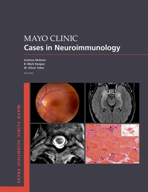 Mayo Clinic Cases in Neuroimmunology (Paperback)