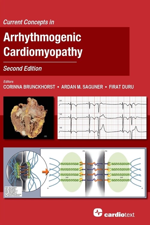 Current Concepts in Arrhythmogenic Cardiomyopathy, Second Edition (Hardcover)