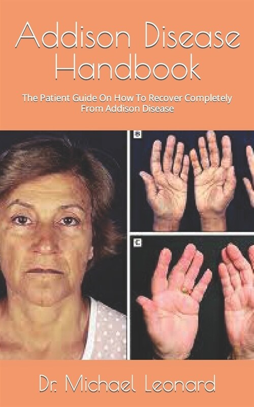 Addison Disease Handbook: The Patient Guide On How To Recover Completely From Addison Disease (Paperback)