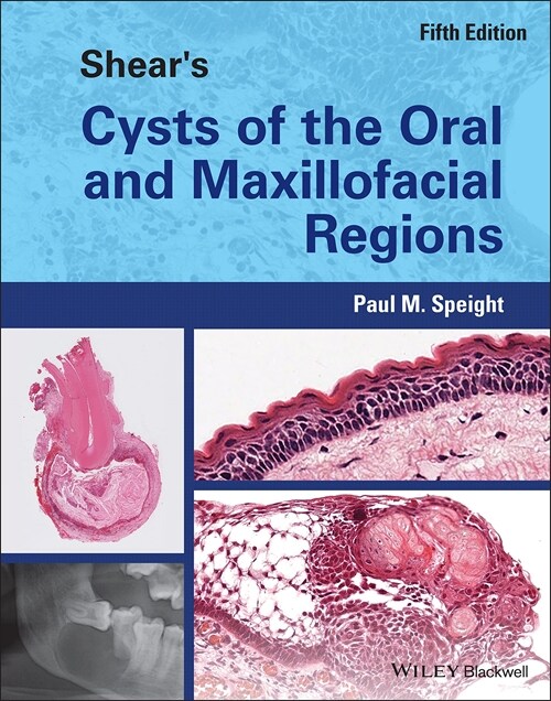 Shears Cysts of the Oral and Maxillofacial Regions (Hardcover, 5 ed)