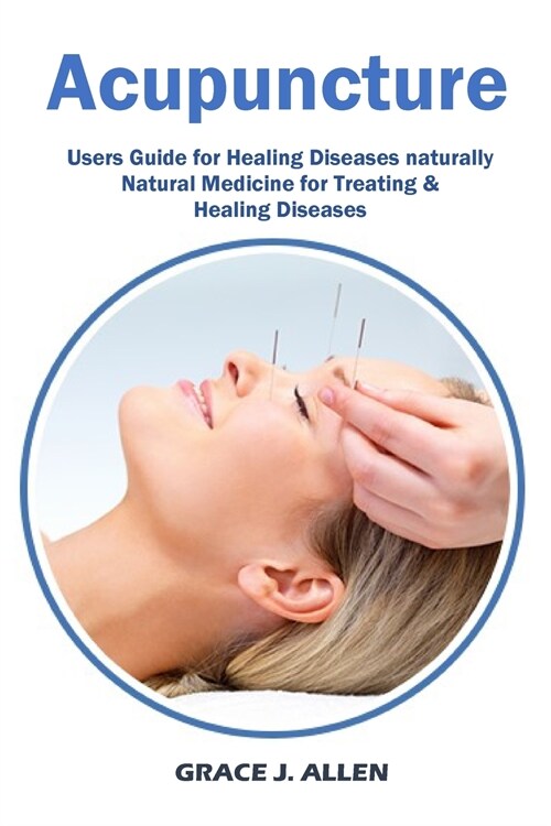 Acupuncture: Users Guide for Healing Diseases naturally Natural Medicine for Treating & Healing Diseases (Paperback)