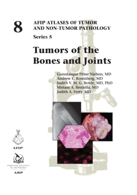 Tumors of the Bones and Joints (Hardcover)