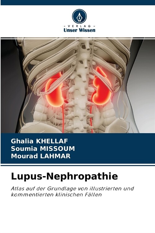 Lupus-Nephropathie (Paperback)