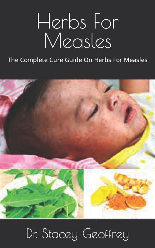 Herbs For Measles: The Complete Cure Guide On Herbs For Measles (Paperback)