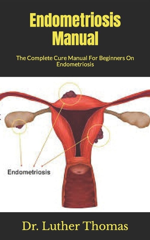 Endometriosis Manual: The Complete Cure Manual For Beginners On Endometriosis (Paperback)
