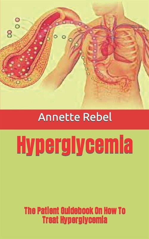 Hyperglycemia: The Patient Guidebook On How To Treat Hyperglycemia (Paperback)