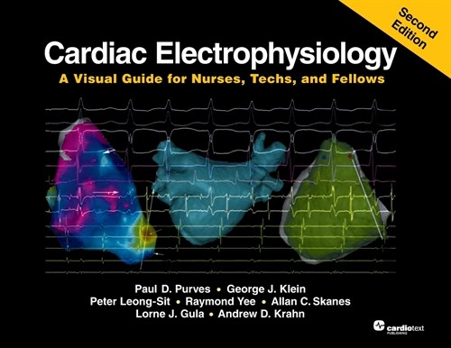 Cardiac Electrophysiology: A Visual Guide for Nurses, Techs, and Fellows, Second Edition (Paperback)