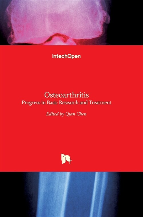 Osteoarthritis : Progress in Basic Research and Treatment (Hardcover)